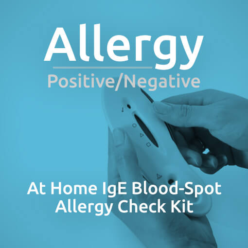 Allergy Check Kit At Home Positive/Negative Allergy Test Allergy Testing