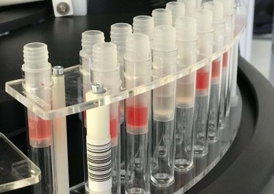 Blood testing for allergies and intolerances