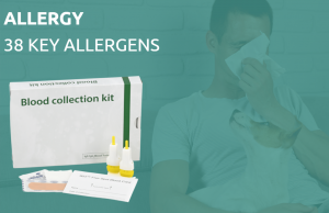 Our Allergy 38 Test.