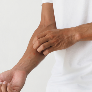 A man scratching his forearm.